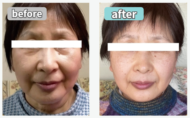 ビフォアー写真