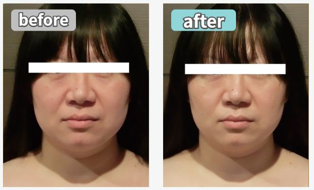 ビフォアー写真